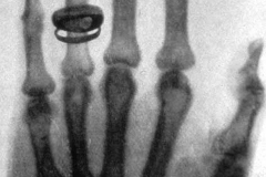 Première photo rayon X, Röntgen, 1895 - domaine public